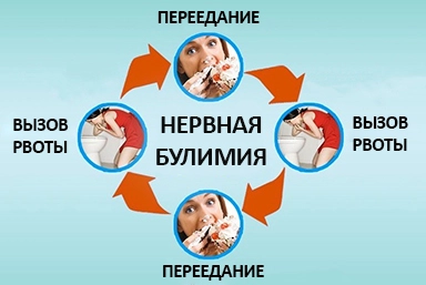 Лечение булимии в Великом Устюге